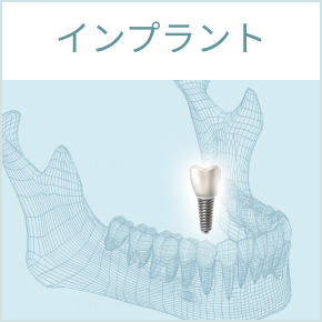 インプラント